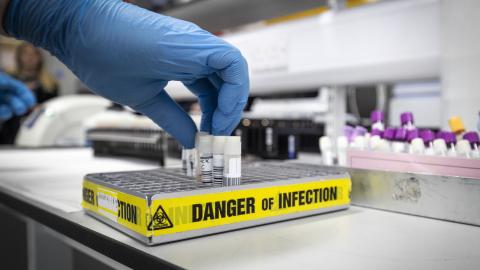 Clinical support technician extracts viruses from swab samples in the coronavirus testing laboratory at Glasgow Royal Infirmary, on February 19, 2020, in Glasgow, Scotland. (Getty Images)